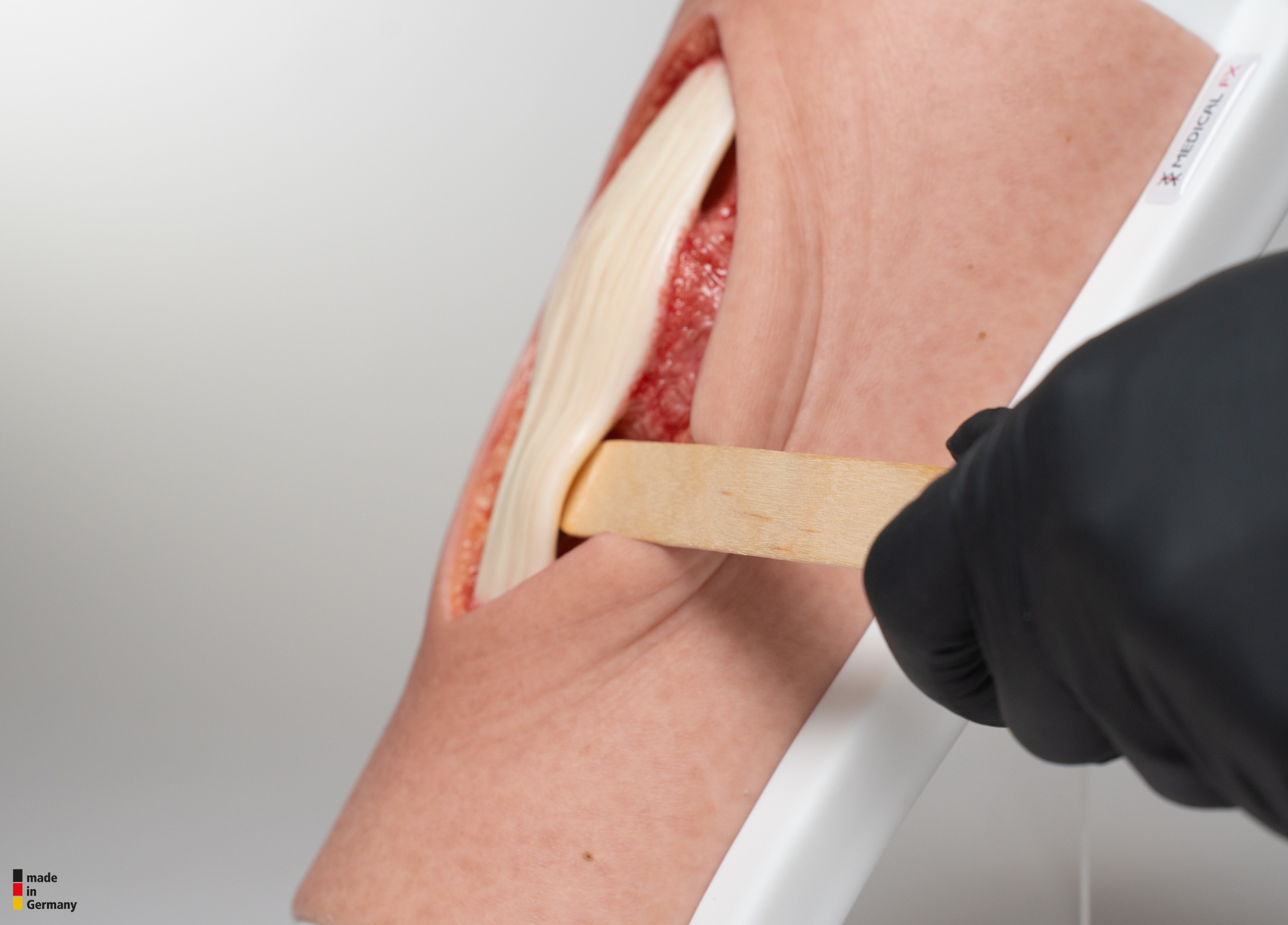 Knie mit 2 freiliegenden Sehnen, Patellasehne, Quadrizepssehne – Bild 7