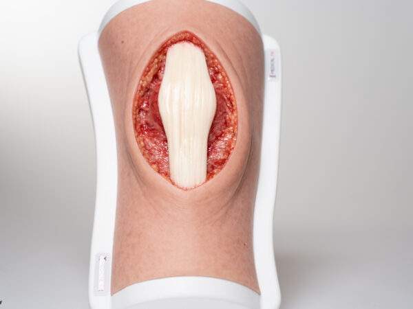 Knie mit 2 freiliegenden Sehnen, Patellasehne, Quadrizepssehne – Bild 8