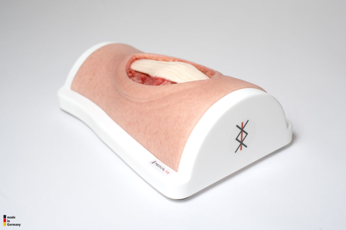 Knie mit 2 freiliegenden Sehnen, Patellasehne, Quadrizepssehne