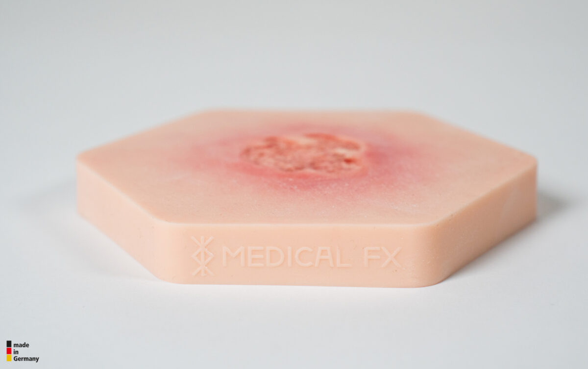 Hexapad Dekubitus Grad 2 flach