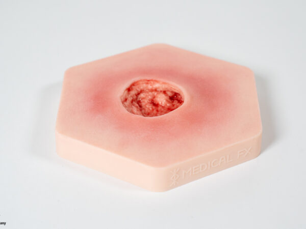 Hexapad Dekubitus Grad 4 tief – Bild 2