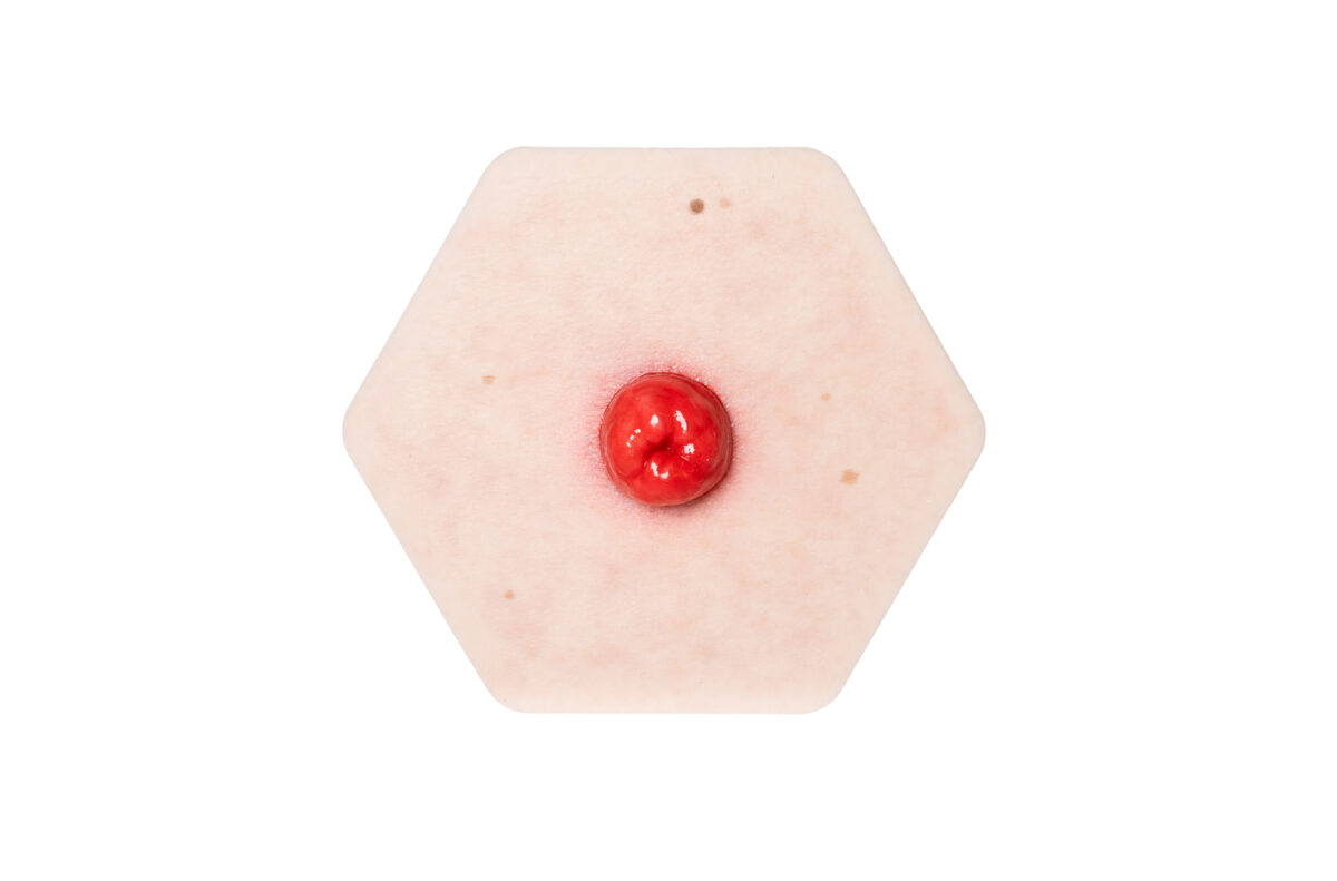 Hexapad Stoma perfekt