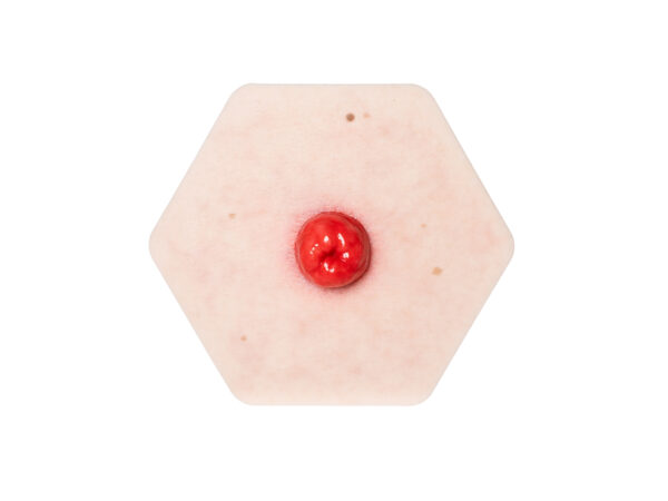 Hexapad Stoma perfekt