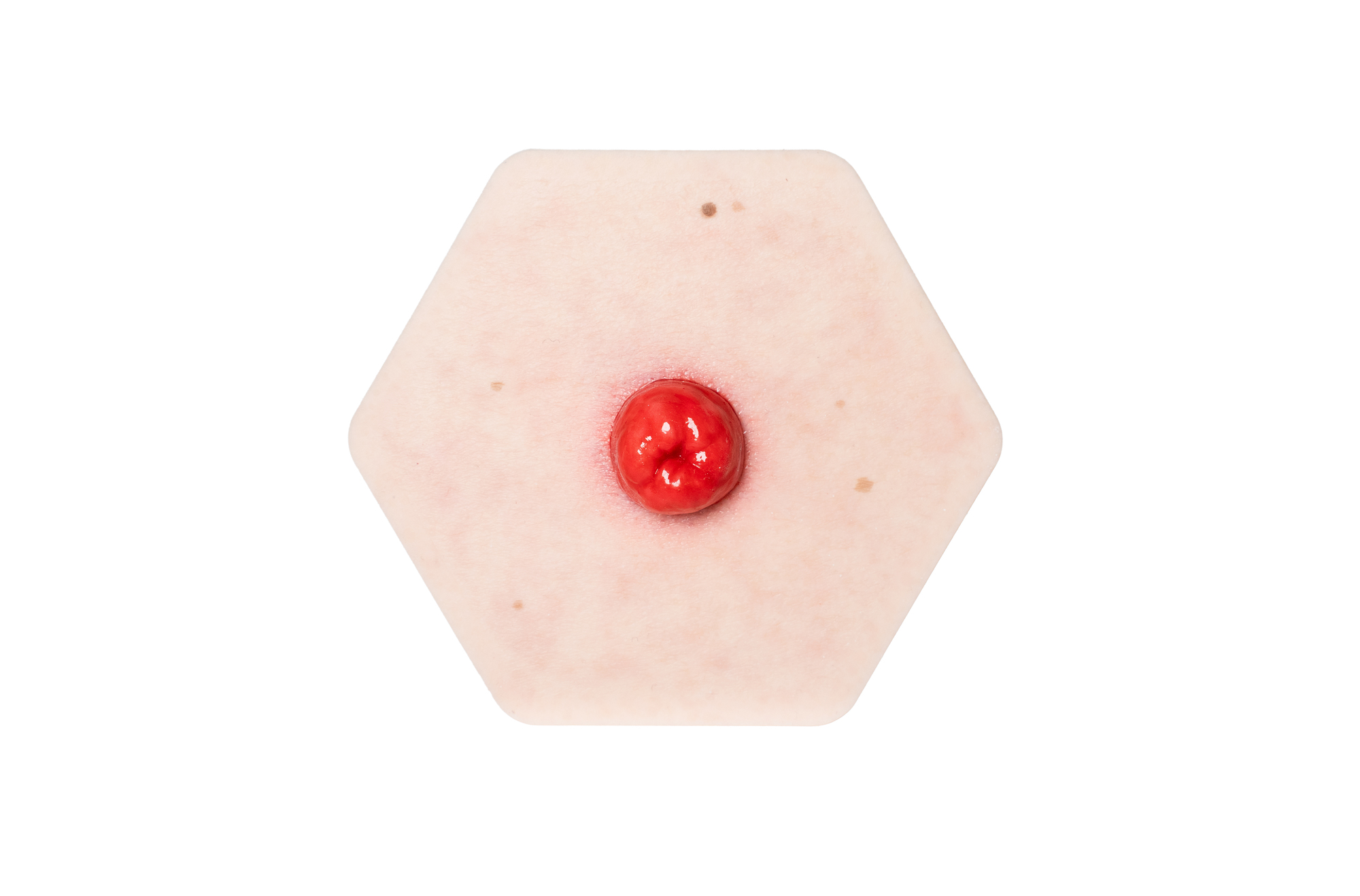Hexapad Stoma perfekt – Bild 1