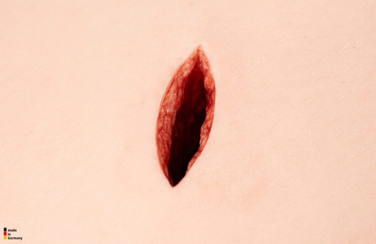 Woundpacking Simulator Stich
