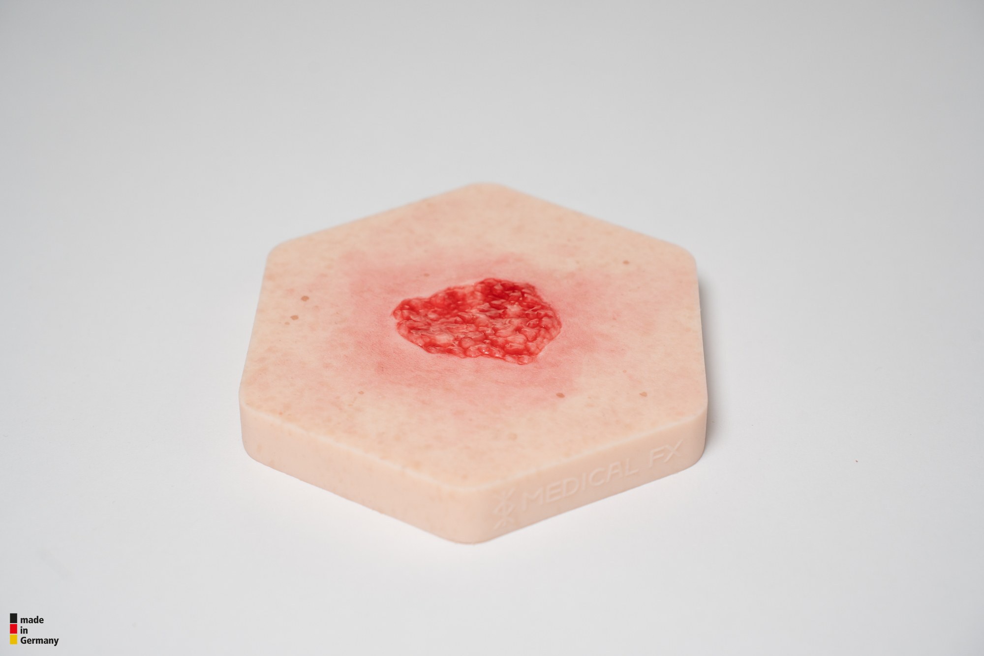 Hexapad Hypergranulation