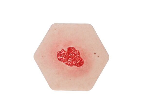 Hexapad Granulation