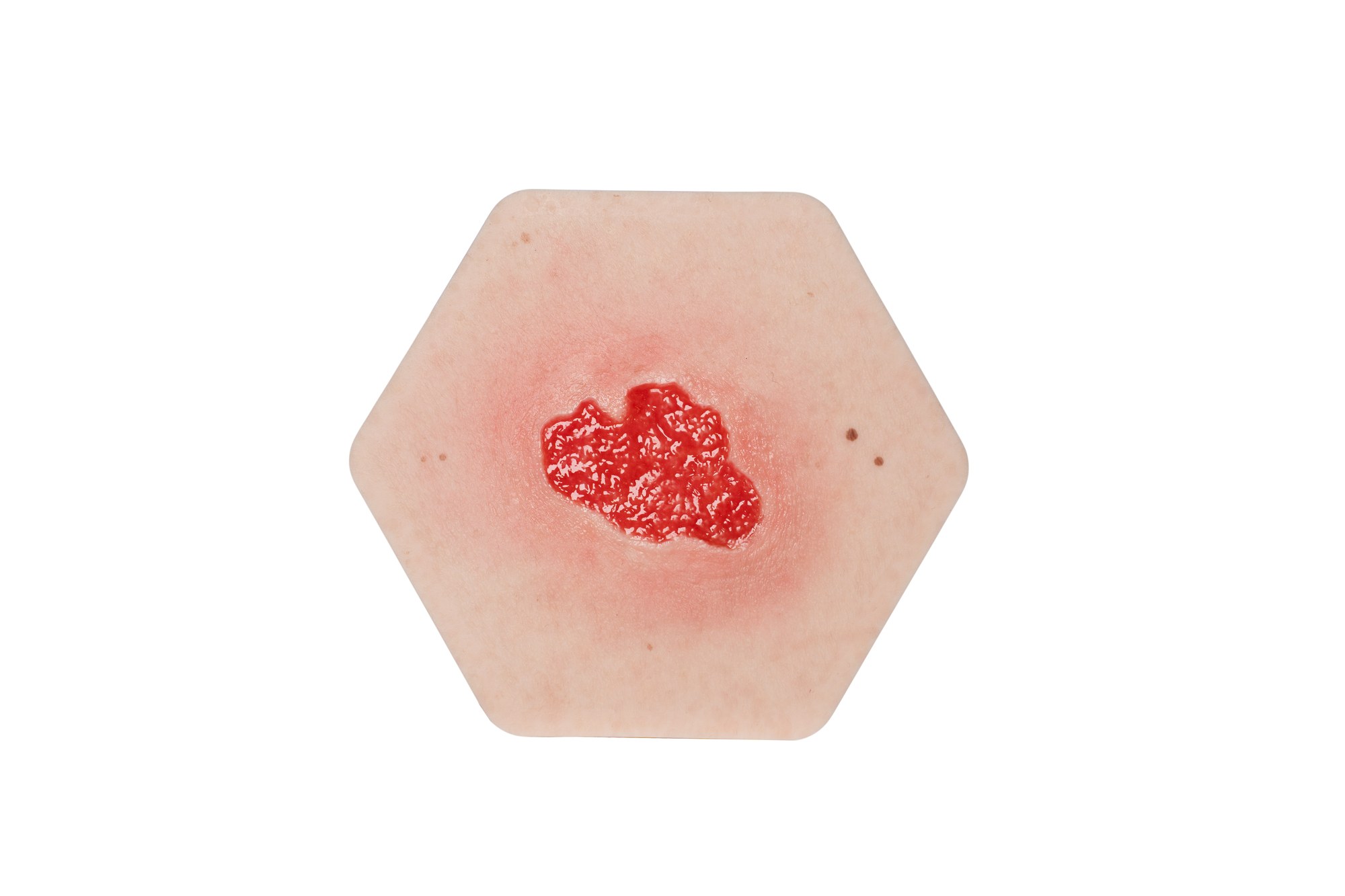 Hexapad Granulation – Bild 1