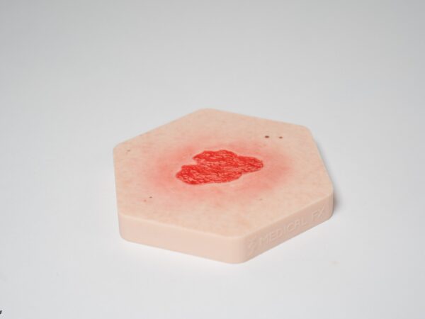 Hexapad Granulation