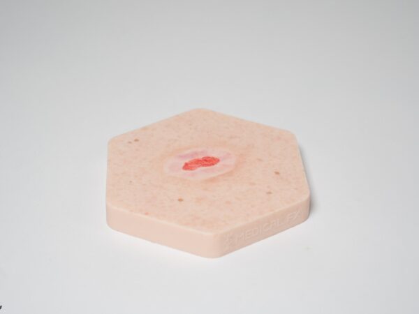 Hexapad Epithelisierung – Bild 2