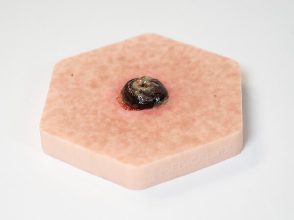 Hexapad Stomie avec nécrose - Image 4