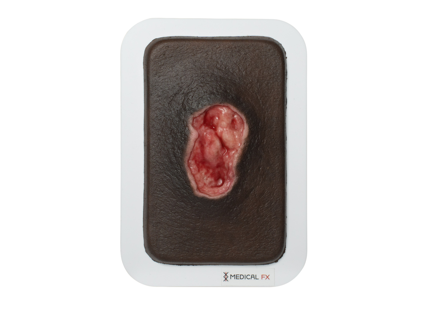 Pocketwound Úlcera por Presión - Image 8