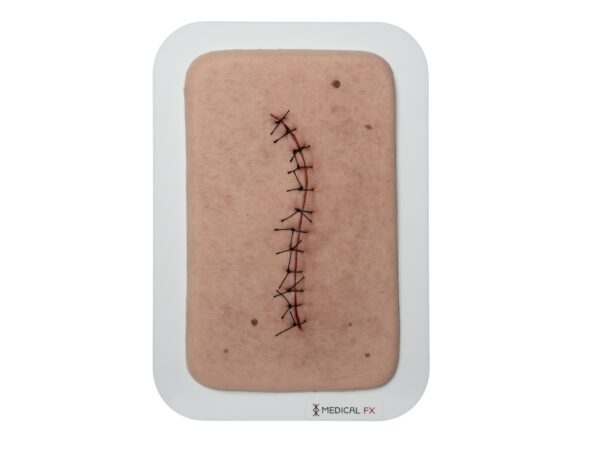 Pocketwound Surgical Wound Perfect
