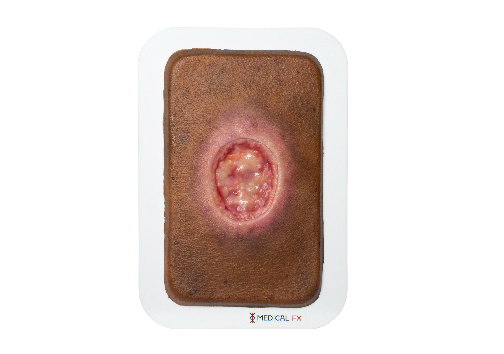 Pocketwound 手術創(MOHS)モデル - Image 6