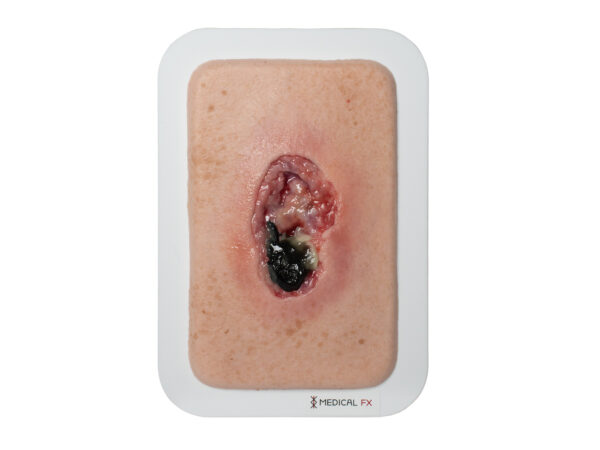 Pocketwound 壊死モデル - Image 1