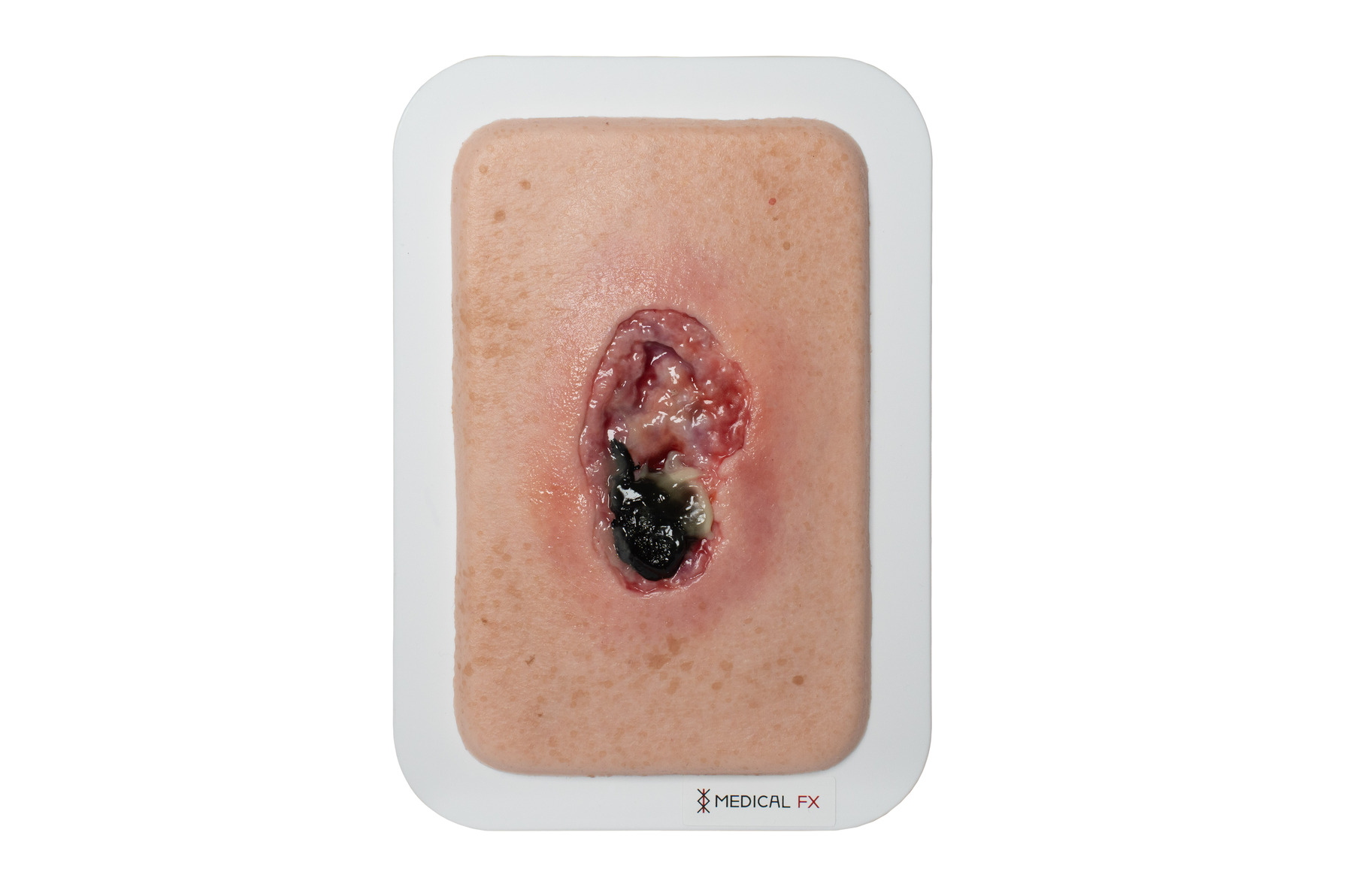 Pocketwound 壊死モデル - Image 1