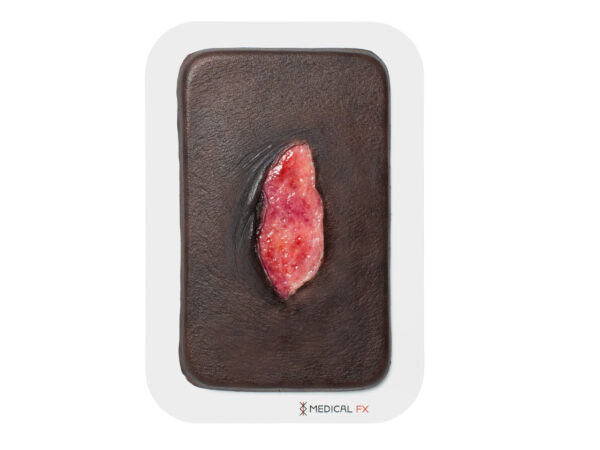Pocketwound 皮膚裂傷モデル - Image 13