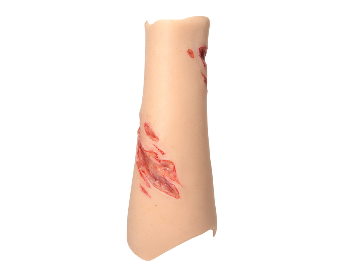 Sleeve Arm mit Risswunde