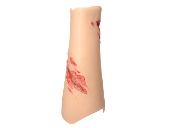 Sleeve Arm with Laceration