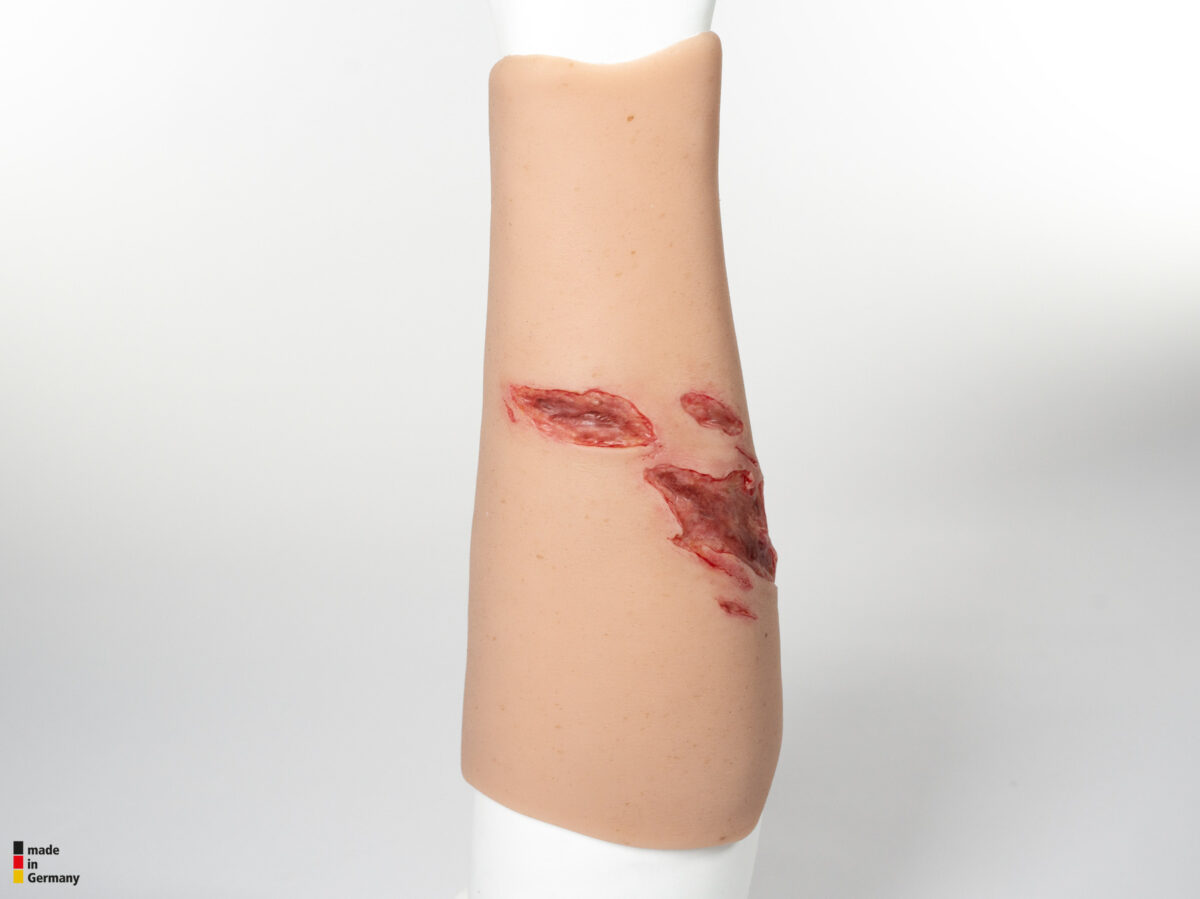 Sleeve Arm mit Risswunde