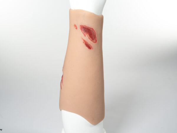 Sleeve Arm mit Risswunde – Bild 3