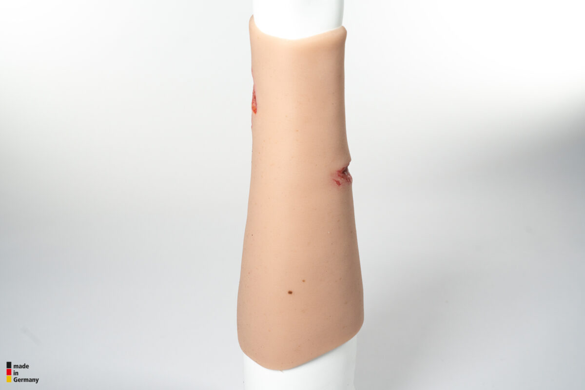 Sleeve Arm mit Risswunde