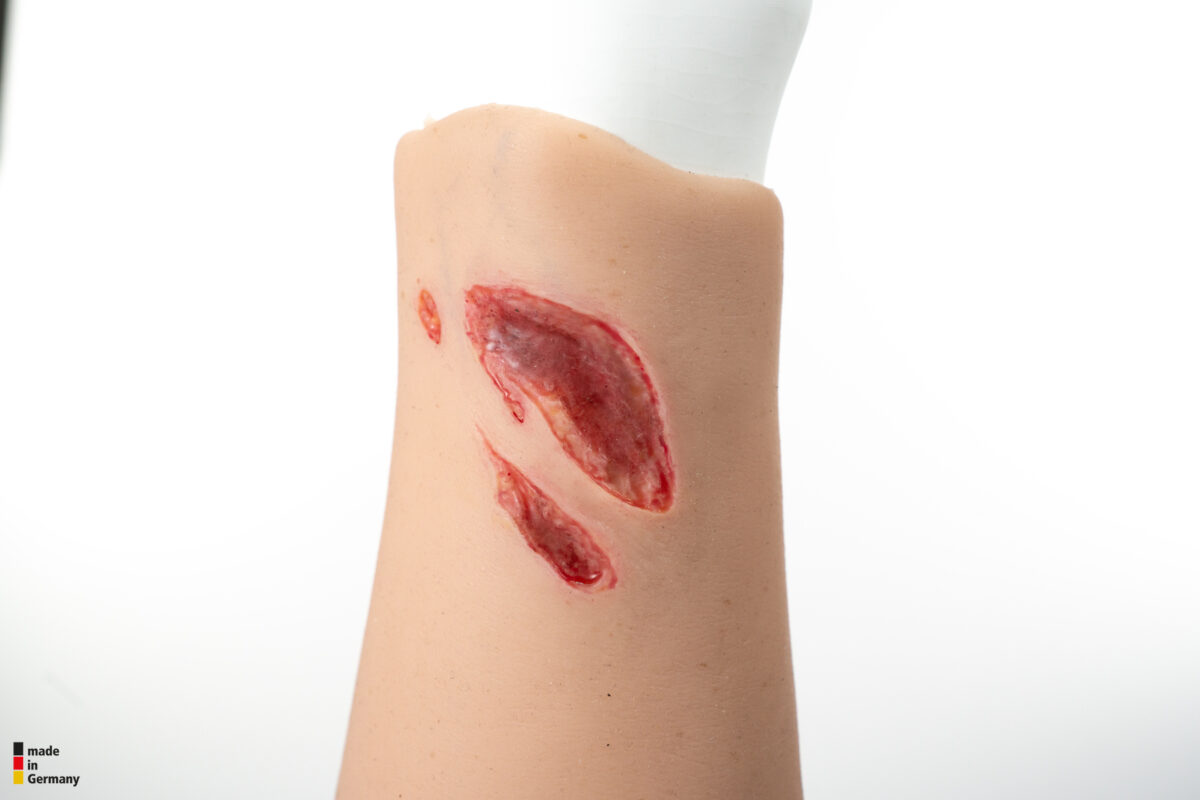 Sleeve Arm mit Risswunde