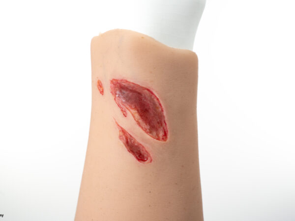 Sleeve Arm mit Risswunde – Bild 8