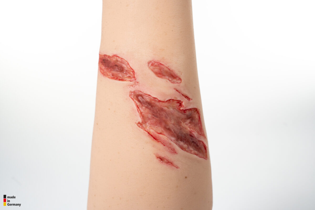Sleeve Arm mit Risswunde