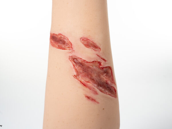 Sleeve Arm mit Risswunde – Bild 9