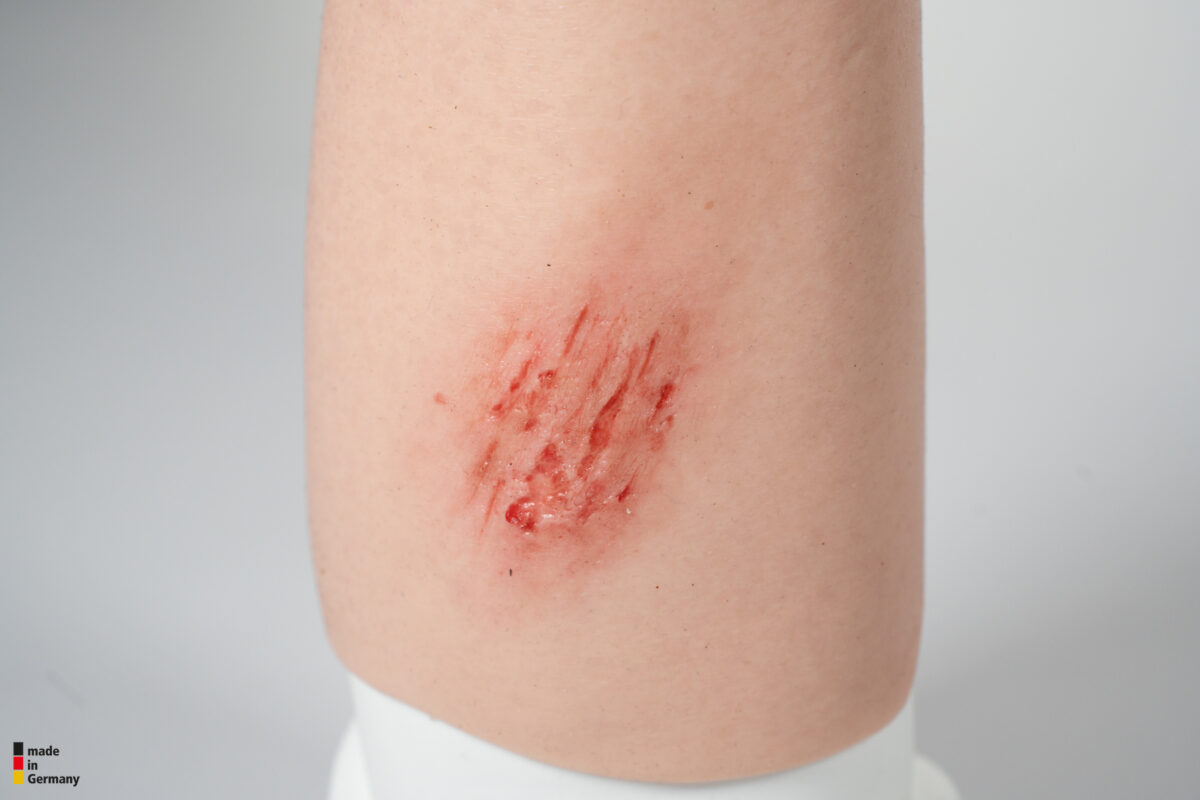 Sleeve Arm with 3 wounds