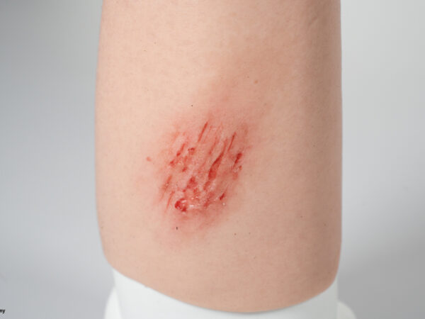 Sleeve Arm with 3 wounds - Image 6