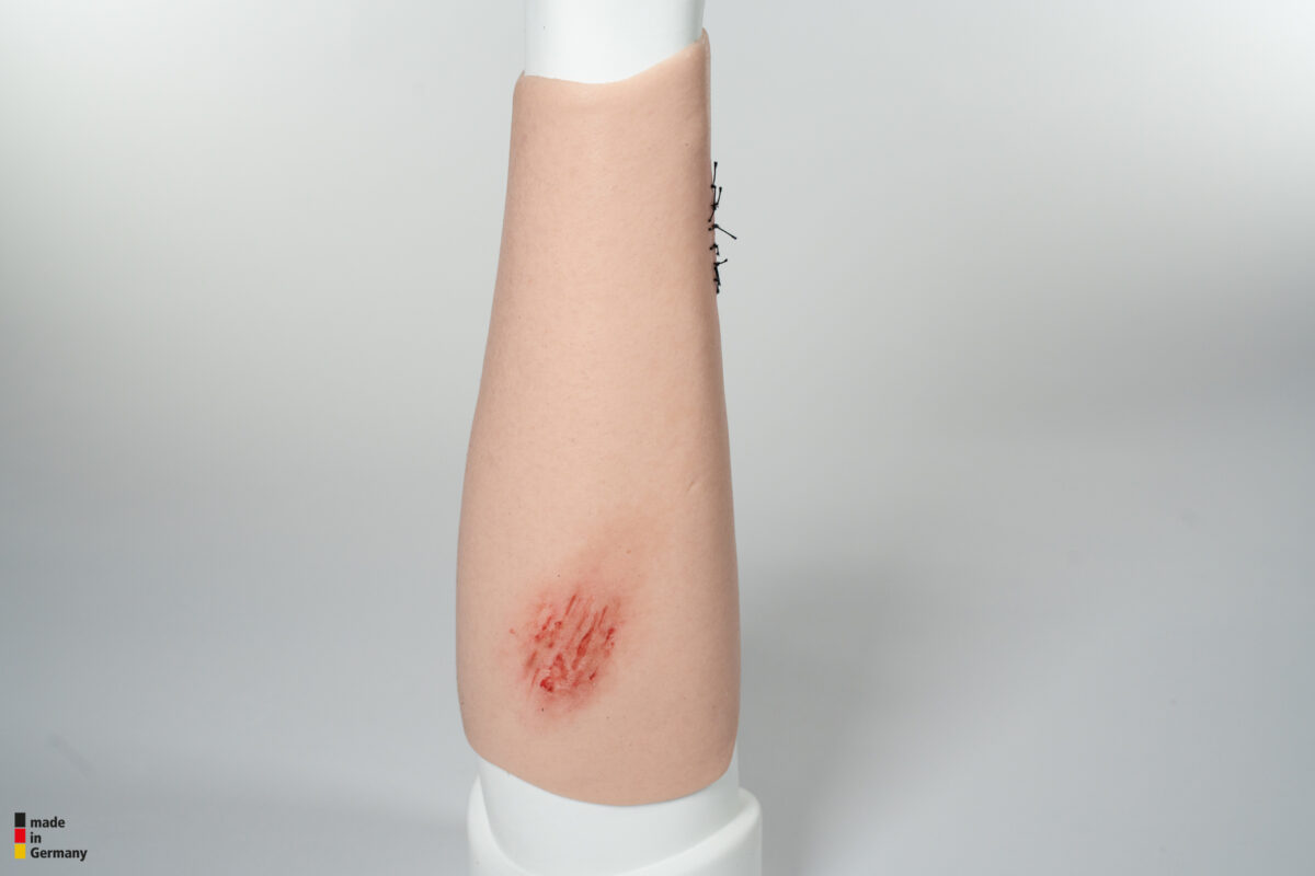 Sleeve Arm with 3 wounds