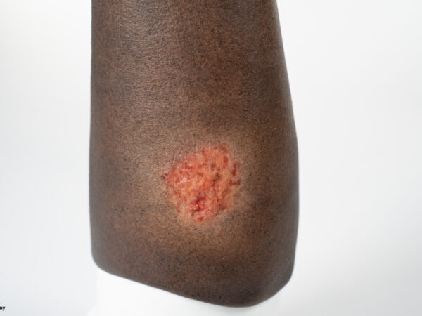 Sleeve Arm with 3 wounds - Image 19