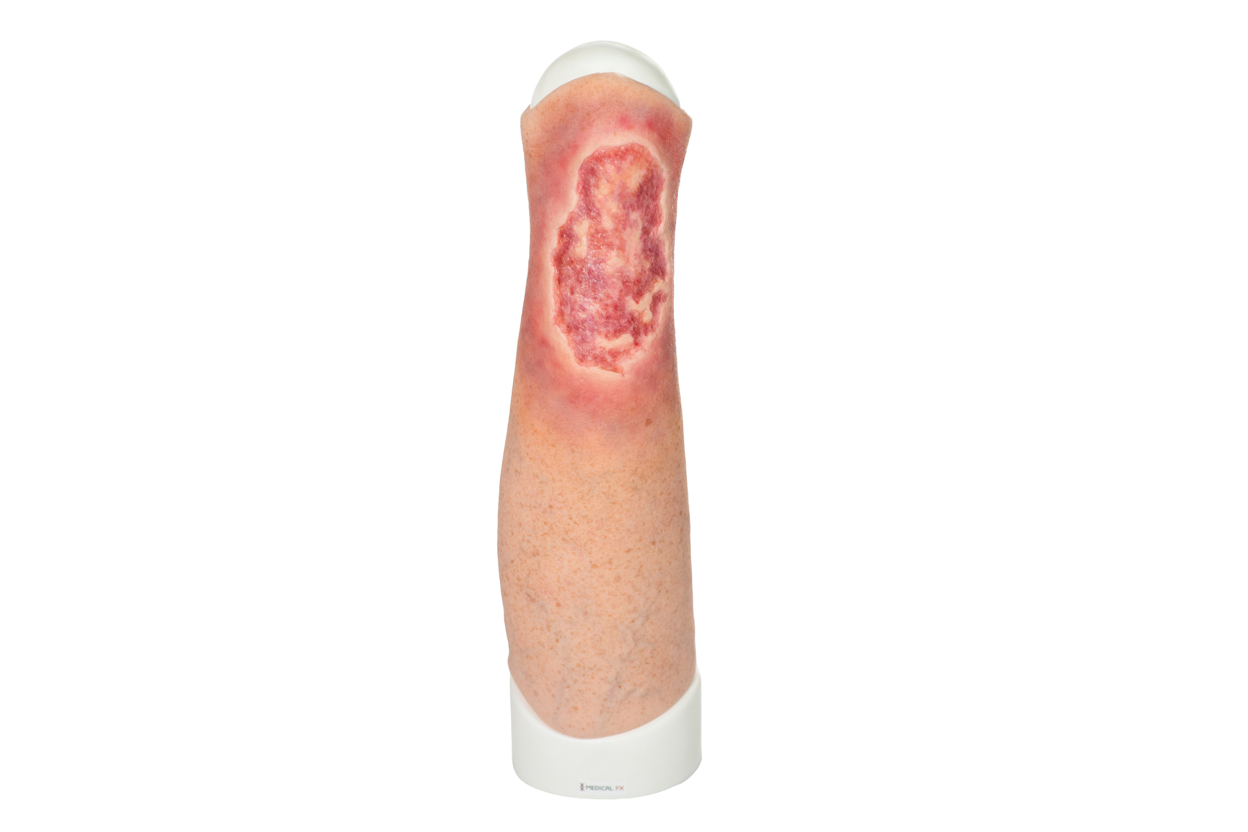 Sleeve Pierna con Úlcera Cruris - Image 1