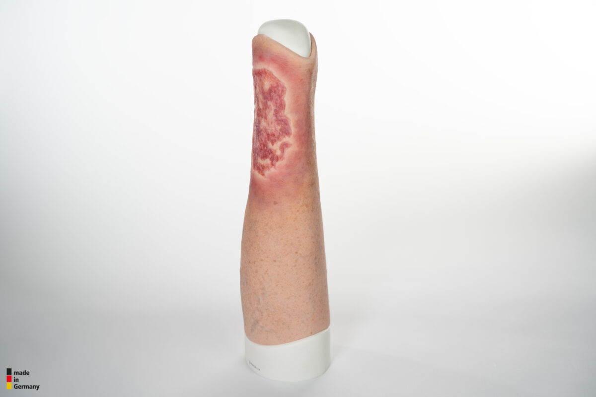 Sleeve Pierna con Úlcera Cruris