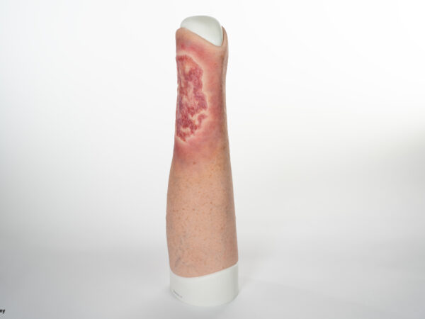 Sleeve Pierna con Úlcera Cruris - Image 3