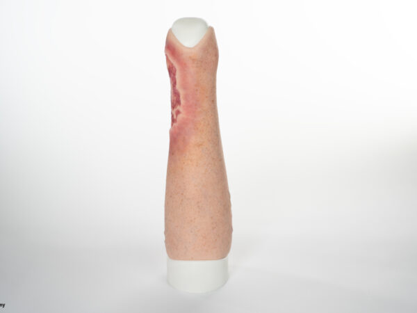 Sleeve Pierna con Úlcera Cruris - Image 4