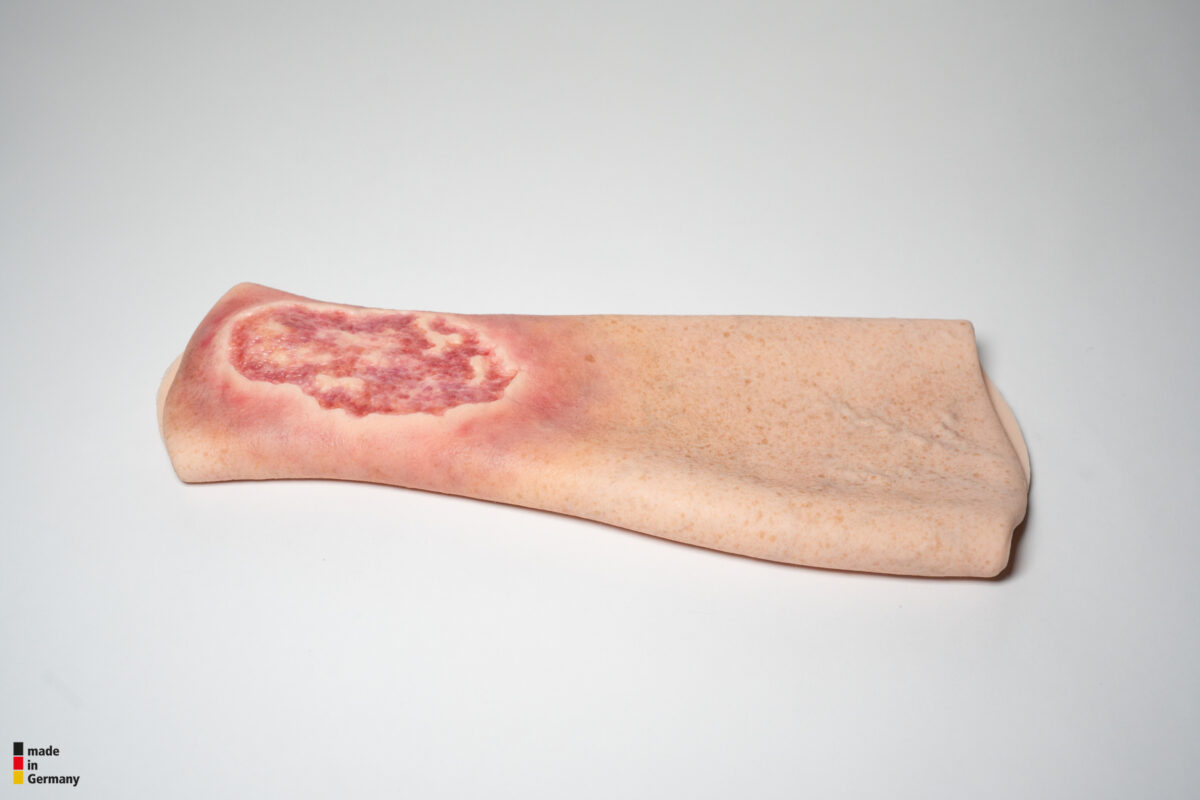 Sleeve Pierna con Úlcera Cruris
