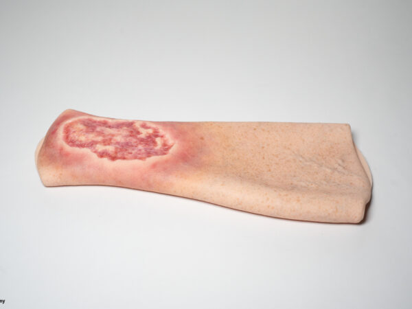 Sleeve Pierna con Úlcera Cruris - Image 7