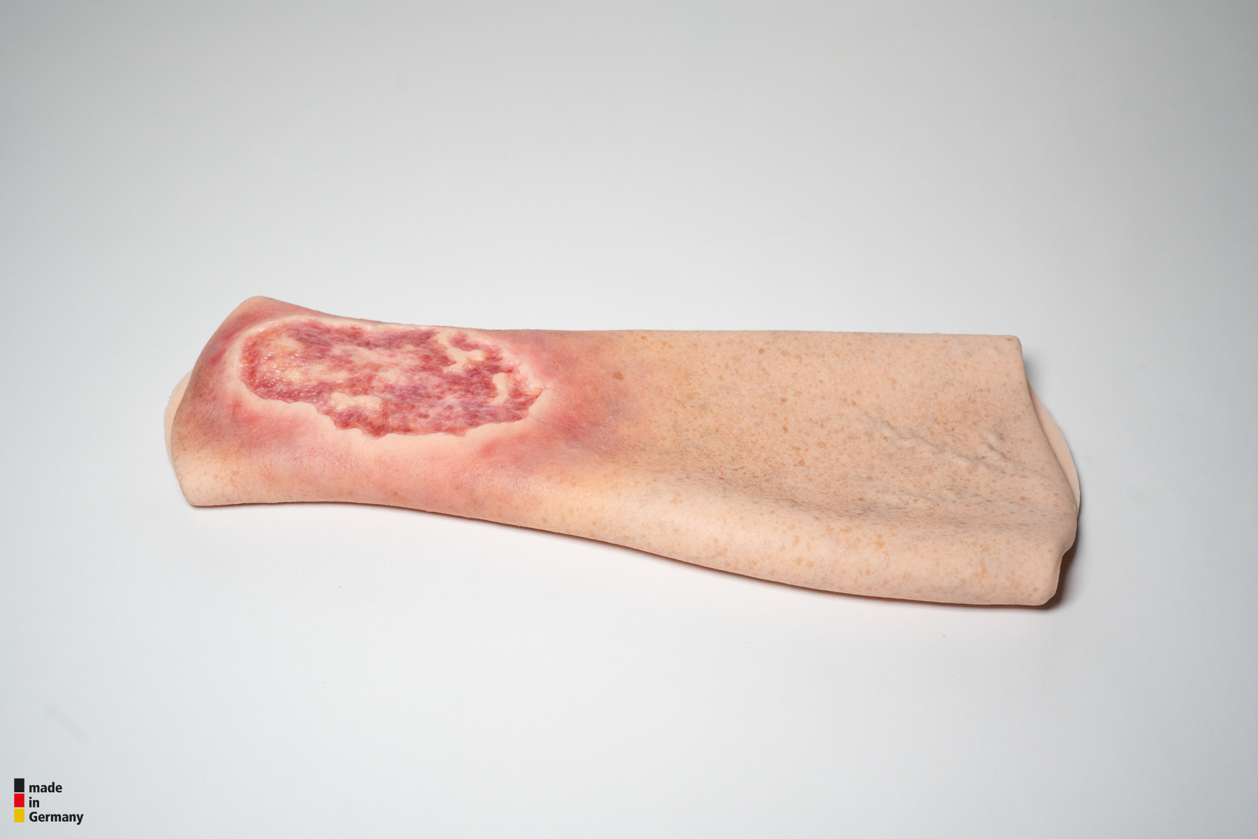Sleeve Pierna con Úlcera Cruris - Image 7