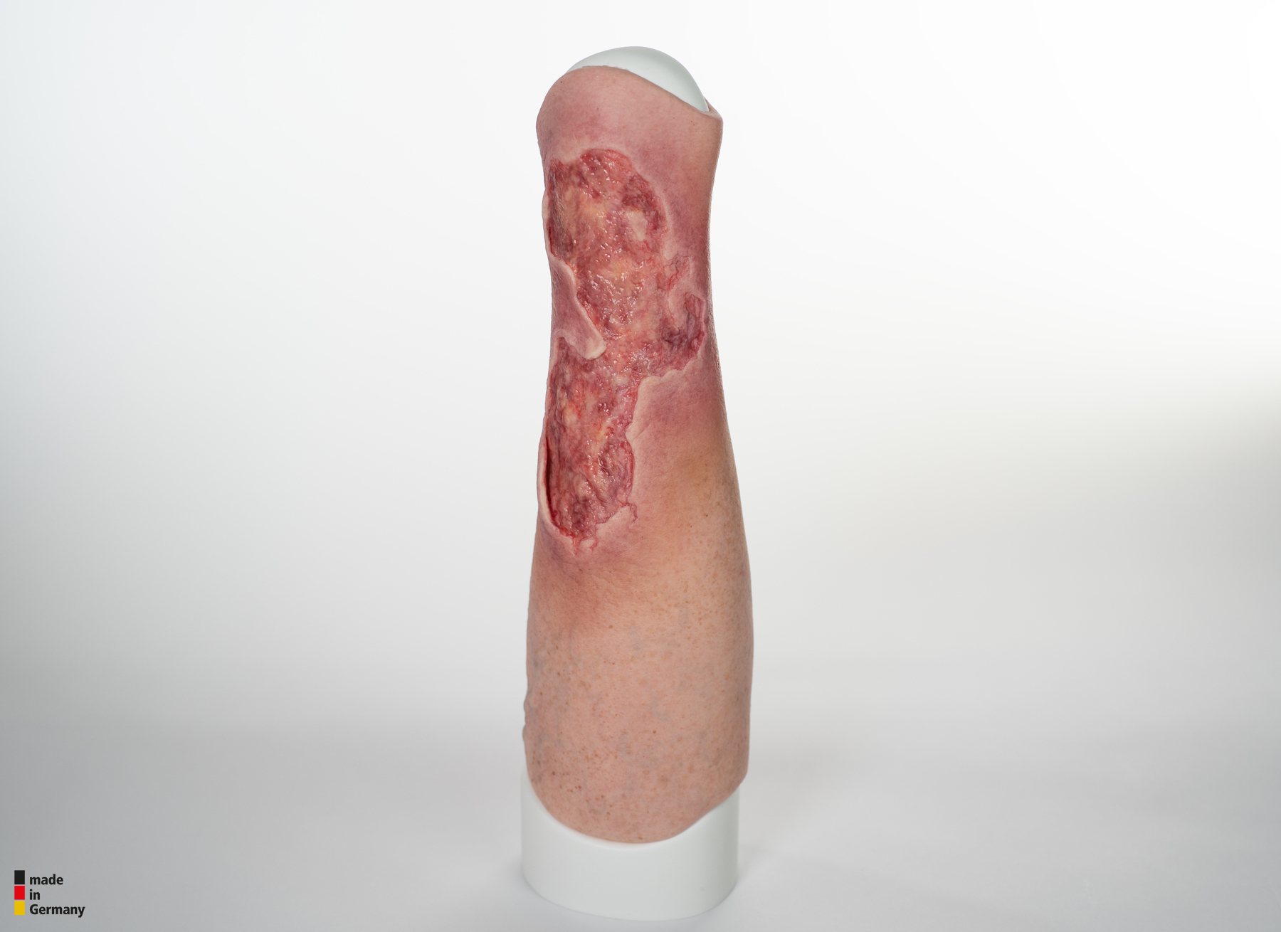 Sleeve Bein mit Gamaschenulkus – Bild 5