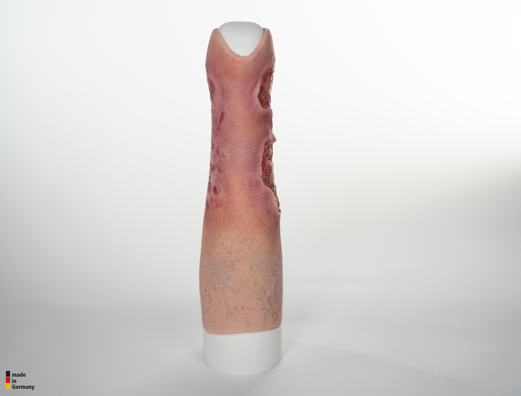 Sleeve Bein mit Gamaschenulkus – Bild 21