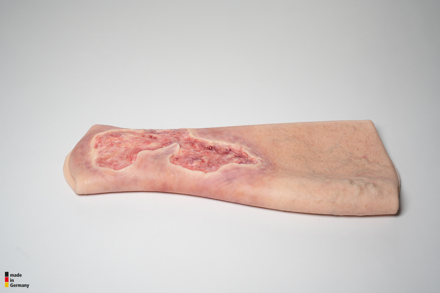 Sleeve Bein mit Gamaschenulkus – Bild 2