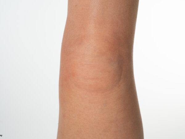 Sockelmodell Bein ohne Wunden – Bild 10