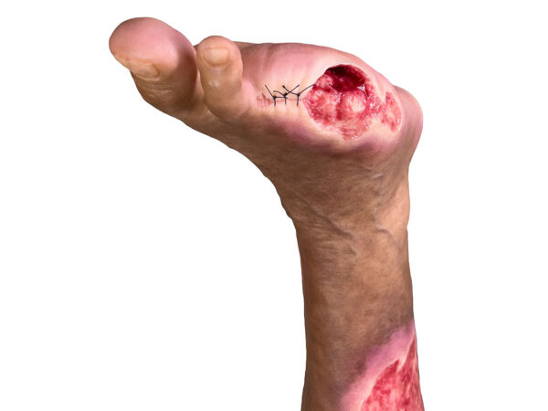 Sockelmodell Bein mit 7 flachen Wunden – Bild 19