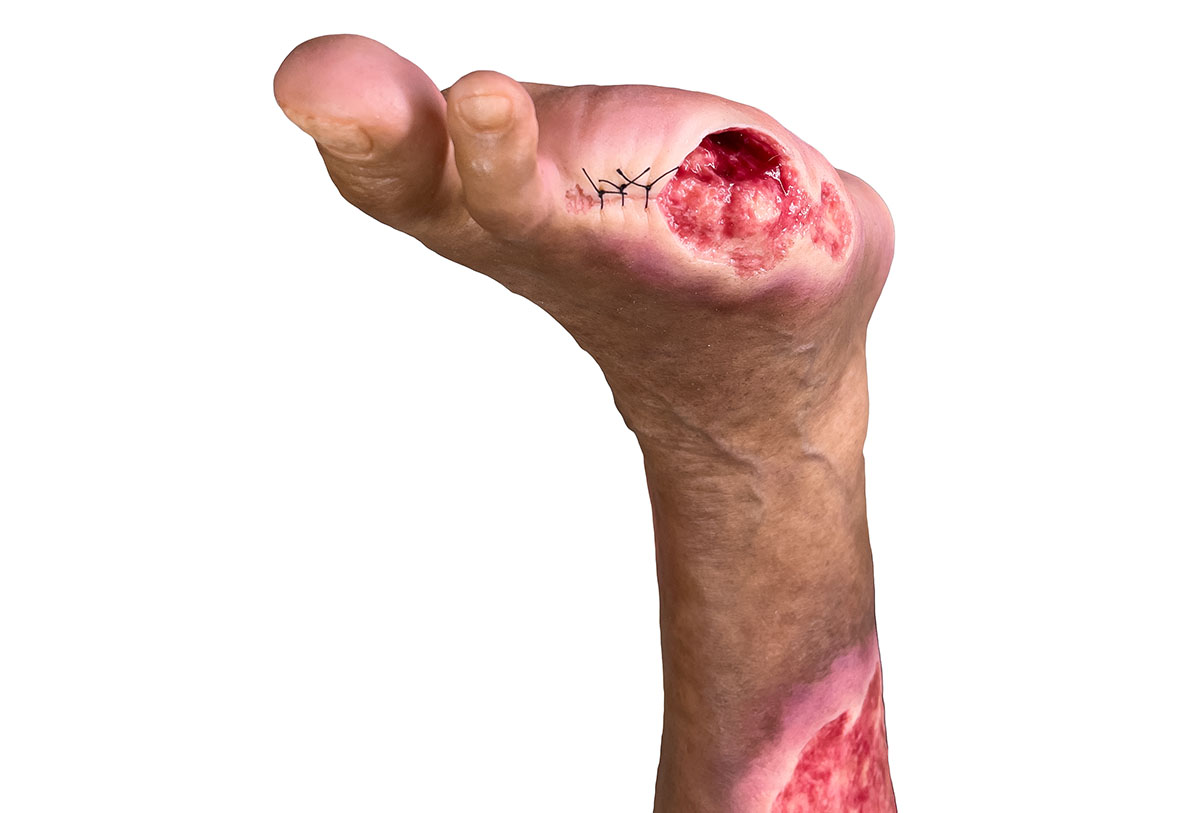 Sockelmodell Bein mit 7 flachen Wunden