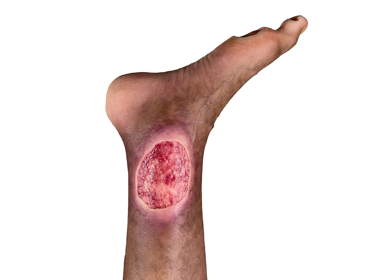 Sockelmodell Bein mit 7 flachen Wunden