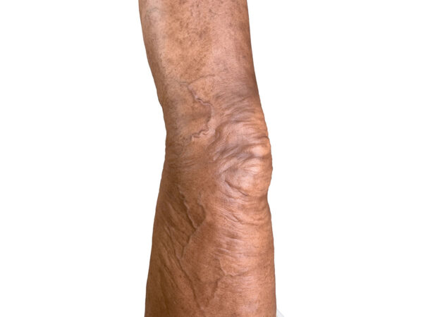 Sockelmodell Bein mit 7 flachen Wunden – Bild 16