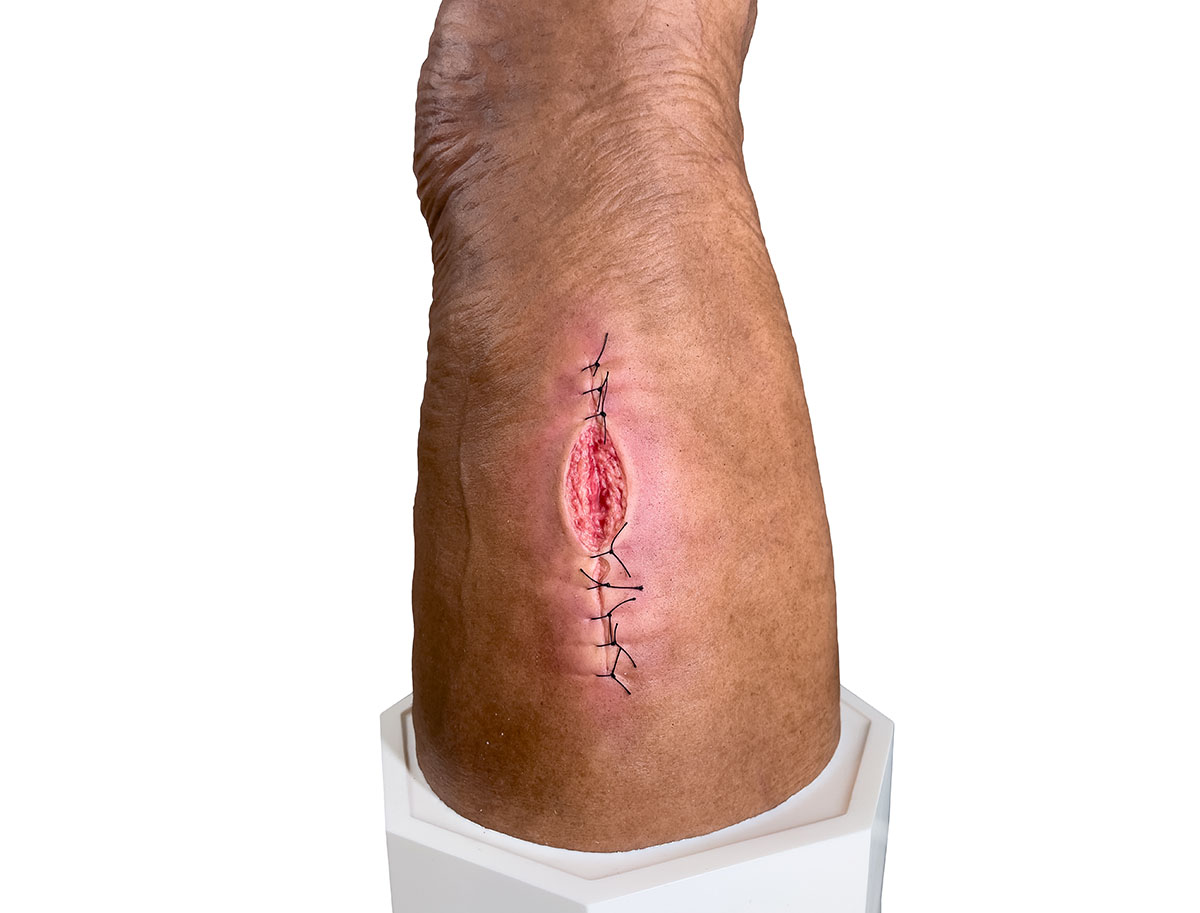Sockelmodell Bein mit 7 flachen Wunden